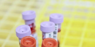 Functional Medicine Test: Preparations & Precautions To Follow white and red plastic tools