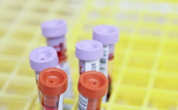 Functional Medicine Test: Preparations & Precautions To Follow white and red plastic tools