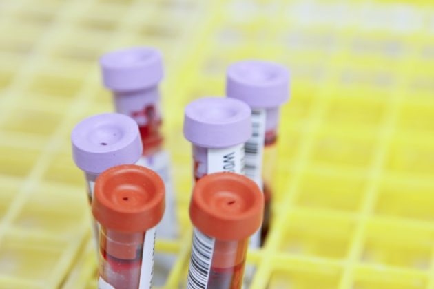 Functional Medicine Test: Preparations & Precautions To Follow