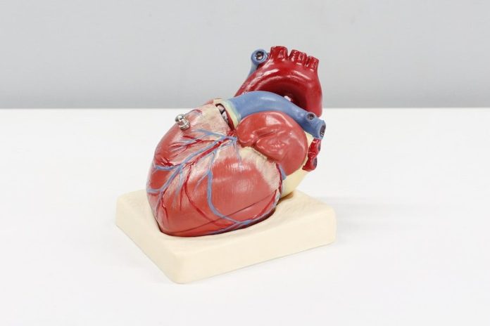 Photo by Ali Hajiluyi a model of a human heart on a white surface