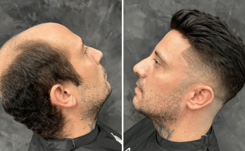 The Step-by-Step Anatomy of a Custom Hair System: From Scalp Template to Final Cut-In